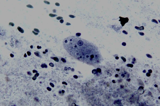 Měňavka úplavičná (Entamoeba Histolytica)