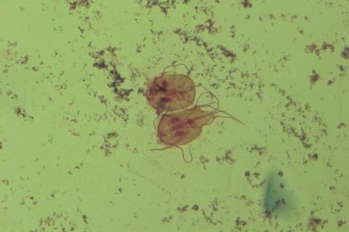Giardia intestinalis – zajímavosti o lambliích