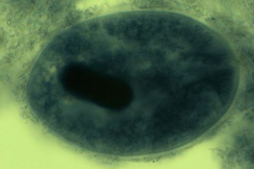 Balantidium coli – úvod do vakovek